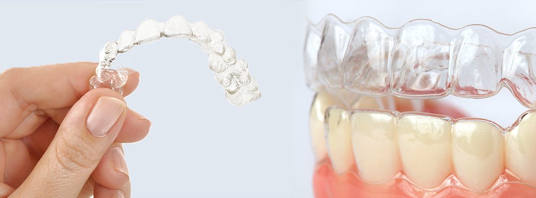 Invisalign Teen® the Alternative to Braces for Teens