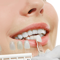 Dental Veneers We provide dental veneers so that patients can restore damaged teeth or transform their smile into something beautiful. At New York Dental Office we often treat patients that have a variety of dental concerns. Some patients visit our New York office because they break their tooth, while others are looking to create a Hollywood smile. Most people are candidates for the procedure as long as their tooth structure and roots are in place. If, however, you have a cavity or gum disease, this will need to be treated before we complete the procedure.